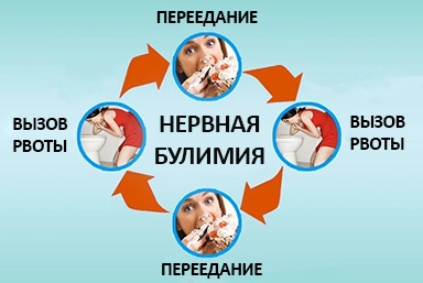 Лечение булимии в Лыткарино